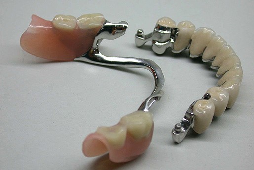 protezy-szkieletowe-bemowodental-clinic