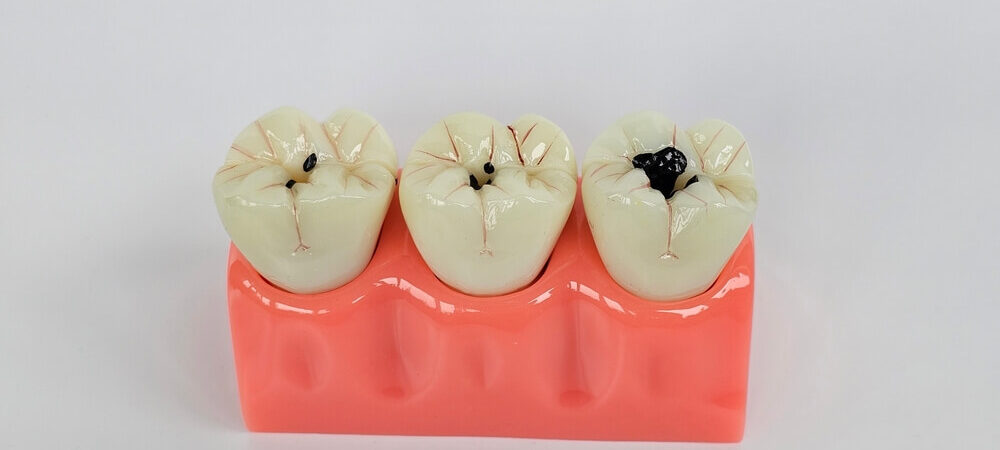 czy-prochnica-jest-choroba-zakazna