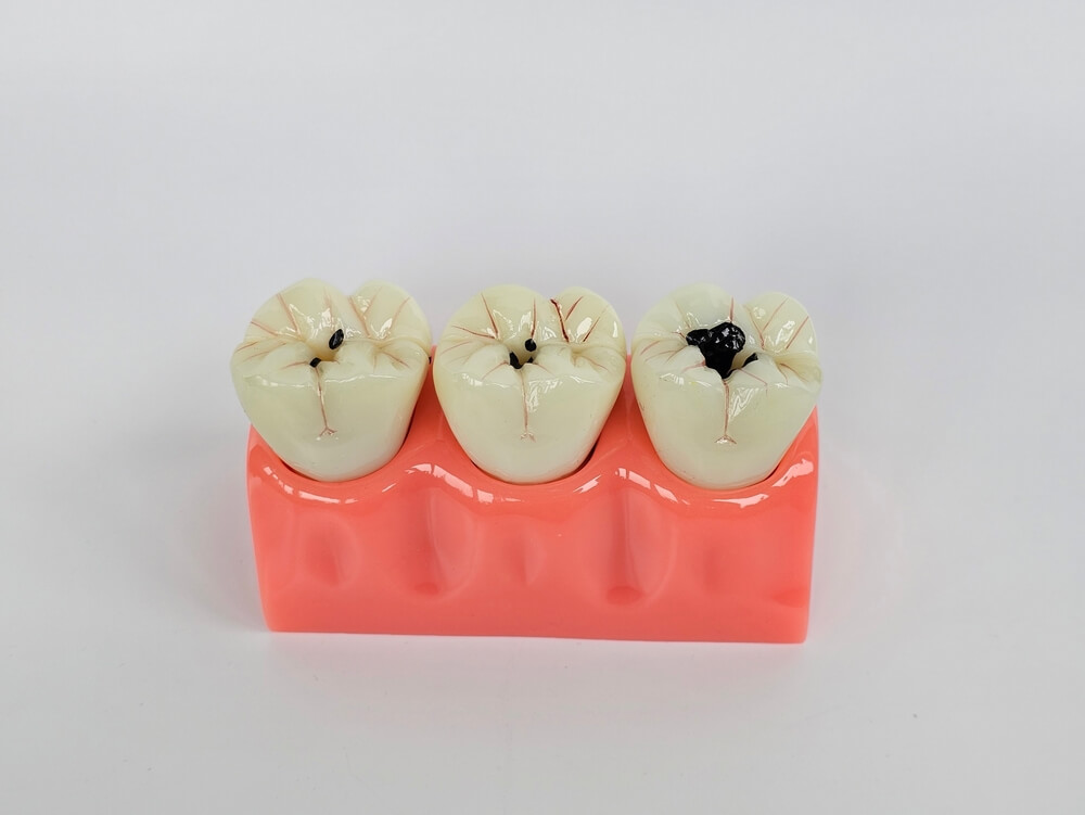 czy-prochnica-jest-choroba-zakazna