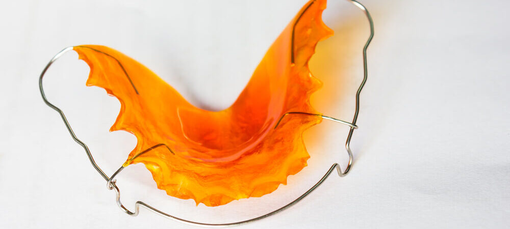 retencja-po-leczeniu-ortodontycznym