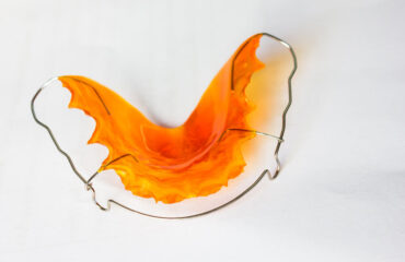 retencja-po-leczeniu-ortodontycznym