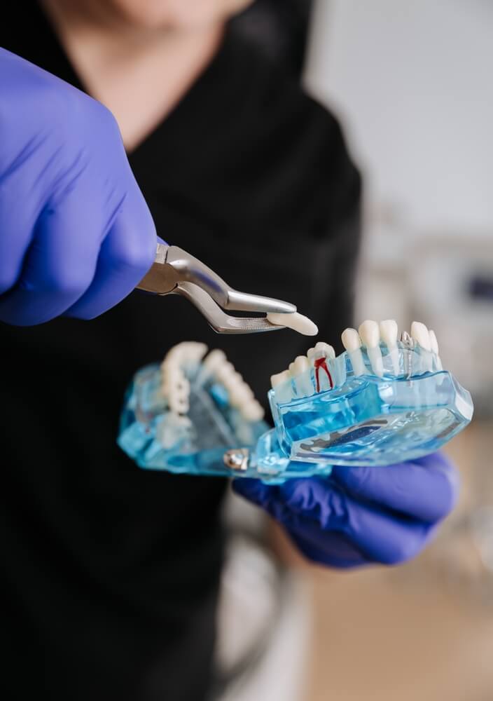 usuwanie-osemek-warszawa