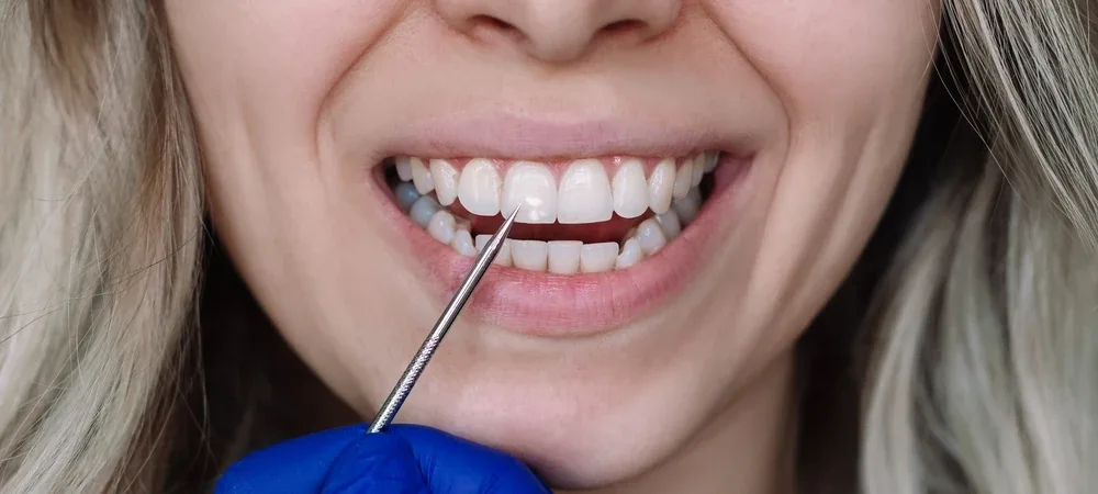 Dentysta wskazuje białą plamę na przednim zębie pacjentki podczas badania stomatologicznego.